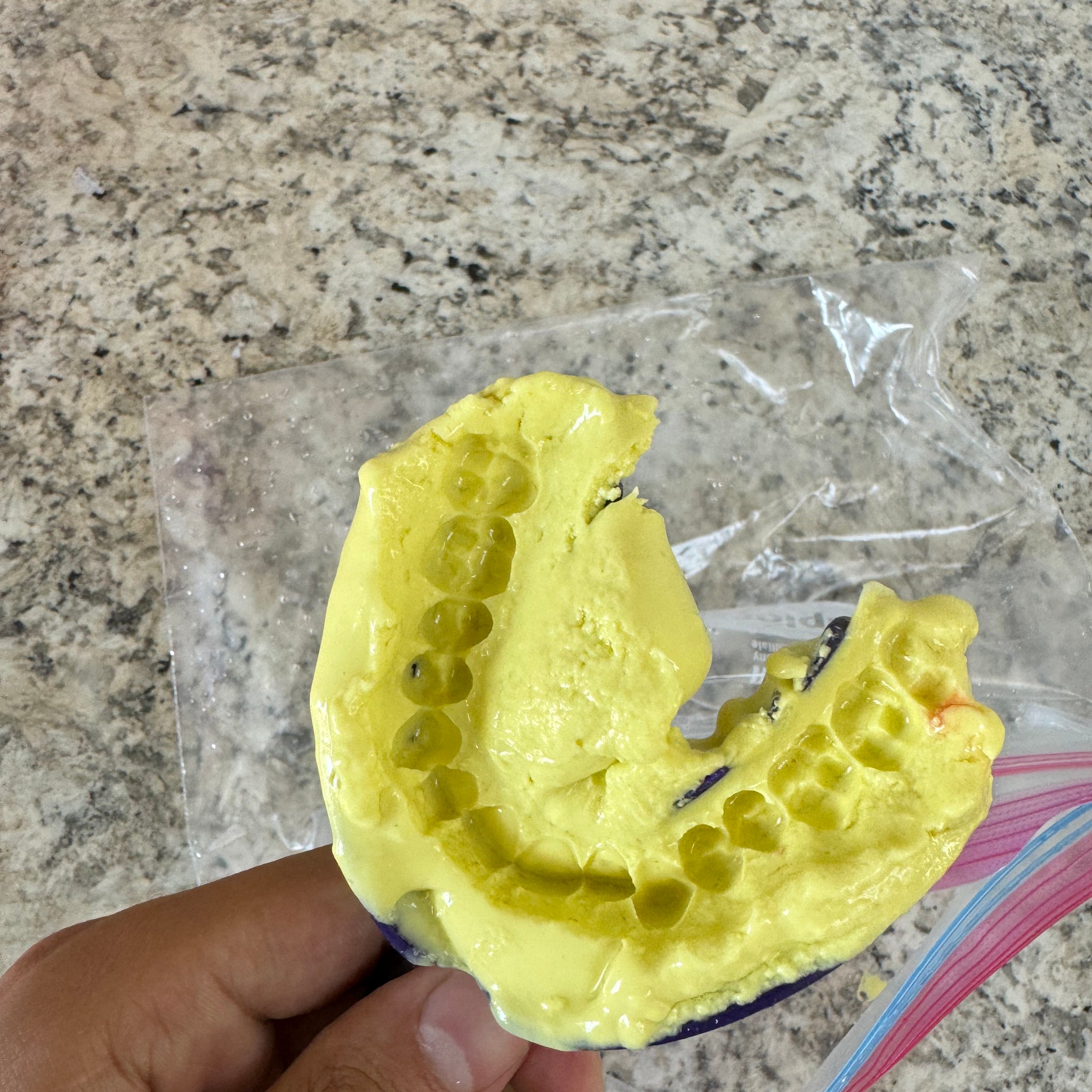 Teeth Mold
